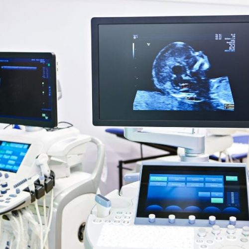Ultrasound Screening